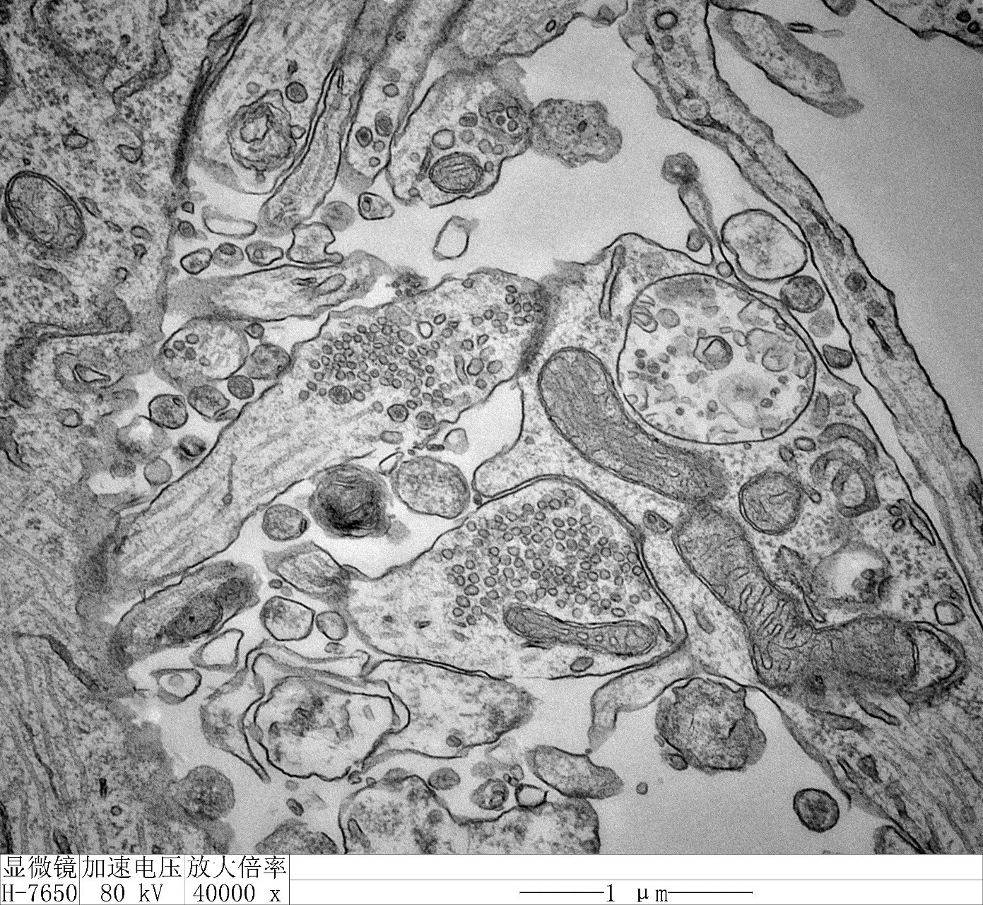 细胞生物学平台透射电镜生物样品制备培训通知-清华大学生命科学学院